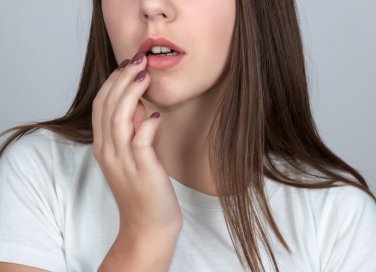 herpes labiale, rimedi naturali, cure