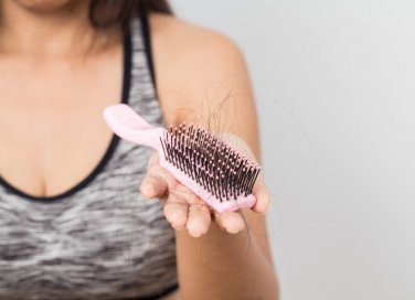 caduta capelli, donne, integratori rinforzanti