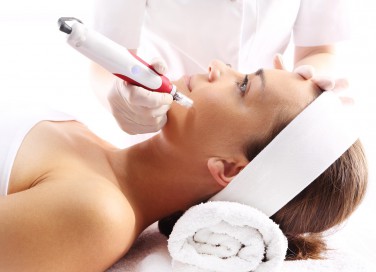 microneedling, rughe, trattamento