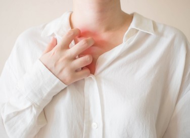 dermatite da sudore, rimedi naturali, trattamento