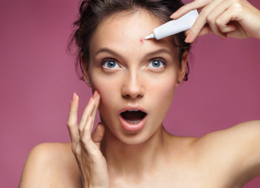 acne giovanile, cause, alimentazione corretta