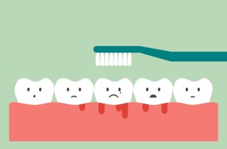 Gengive infiammate: i rimedi naturali per un sollievo veloce