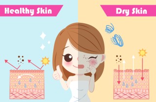 Pelle secca, le cause più strane