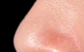 naso, viso, olfatto, sensi, lineamenti, odorato sogno