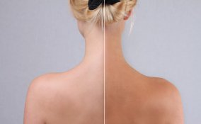 autoabbronzante, come applicare, tintarella chimica