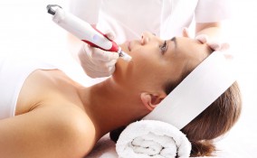 microneedling, rughe, trattamento