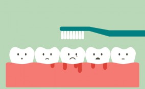 rimedi naturali, gengive infiammate, sollievo