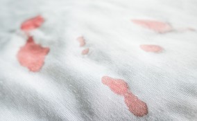 come togliere macchie sangue, macchie sangue tessuti