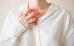 dermatite da sudore, rimedi naturali, trattamento