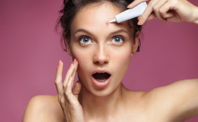 acne giovanile, cause, alimentazione corretta