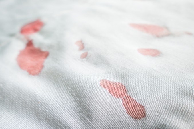 come togliere macchie sangue, macchie sangue tessuti