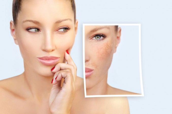 Laser Clear + Brilliant 