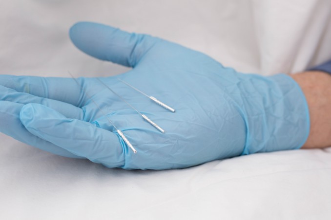  terapia dell'ago secco